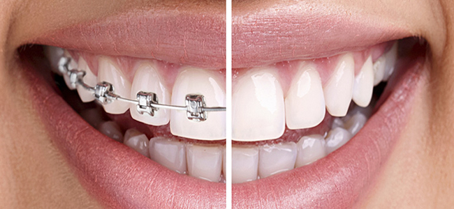 Orthodontics