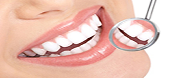 Zirconium Crowns